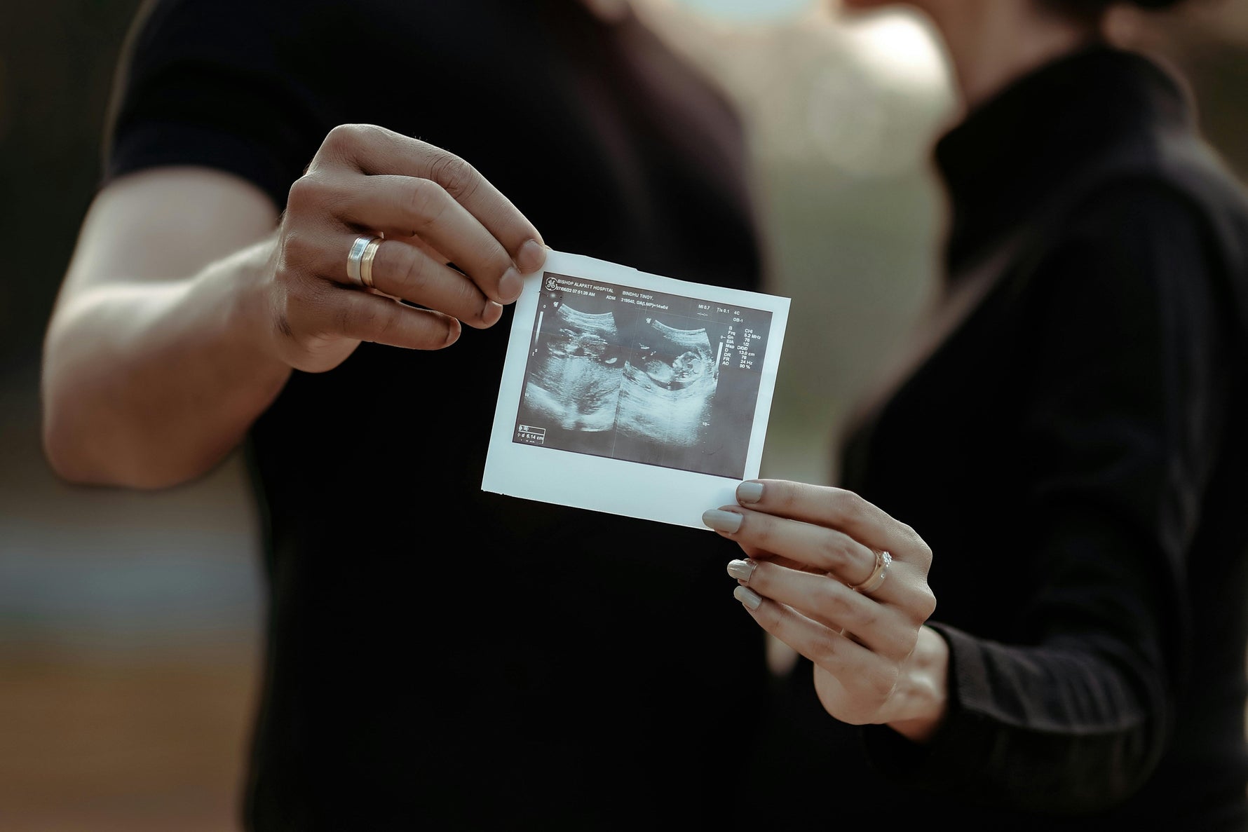 Sindrome di Couvade: Quando i Papà "Sentono" la Gravidanza