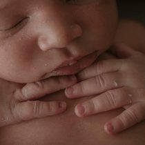 Crosta lattea nel neonato: cause, durata, rimedi dolci e quando preoccuparsi | Mondo Infanzia